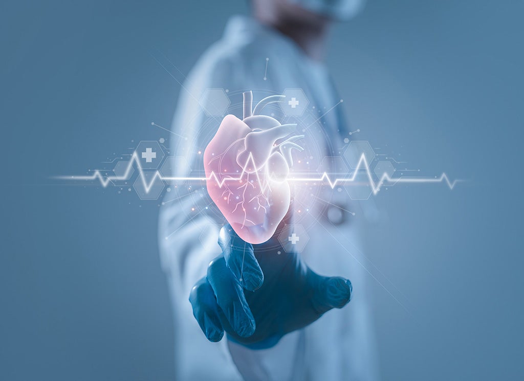 Heart and Vascular Care