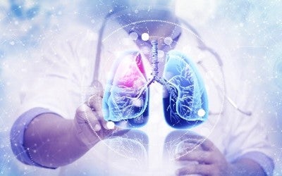 Early-Stage Lung Cancer Detection with New Ion Robotic Technology