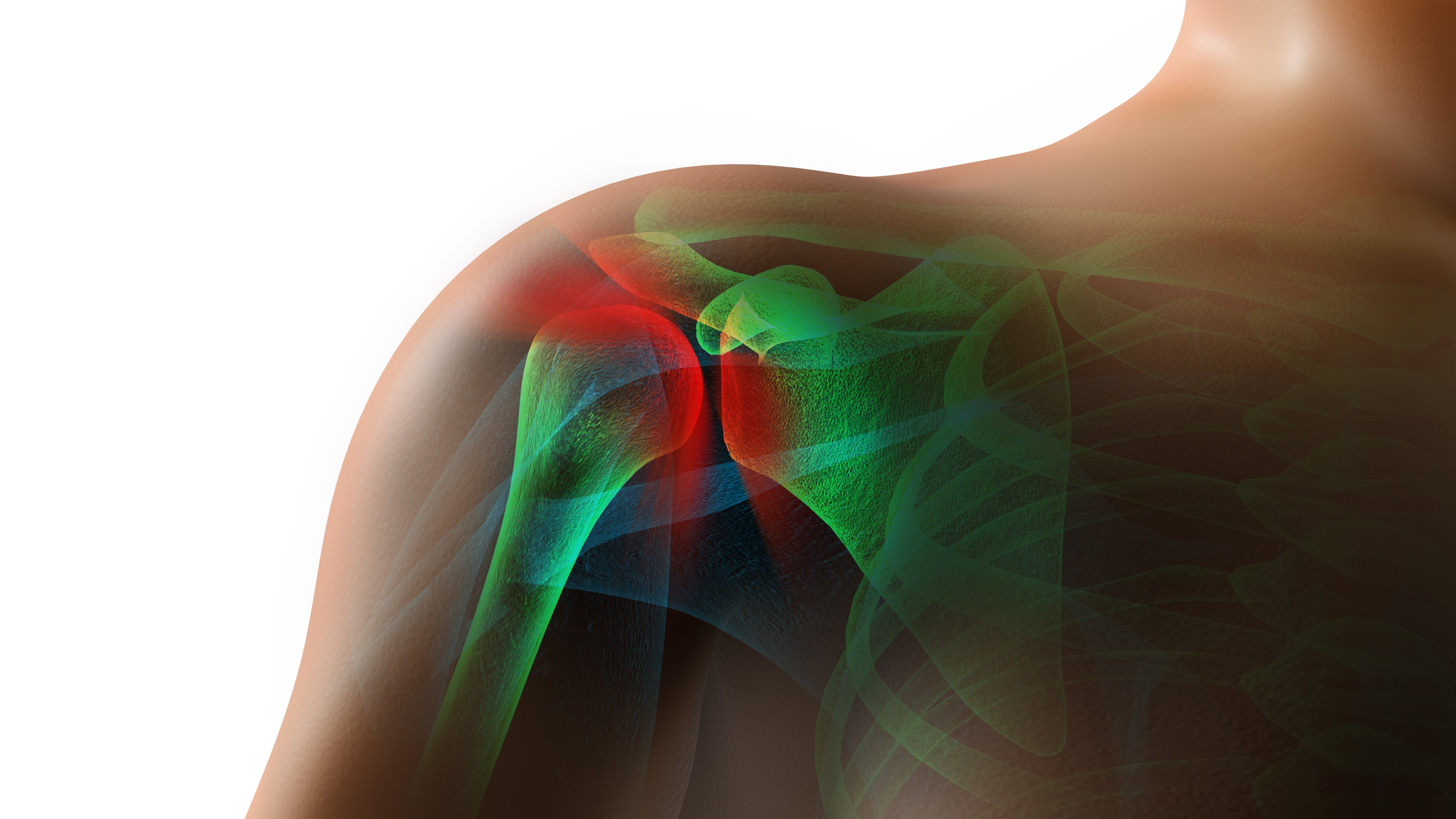 Rotator cuff injuries come with age, but surgery is not inevitable